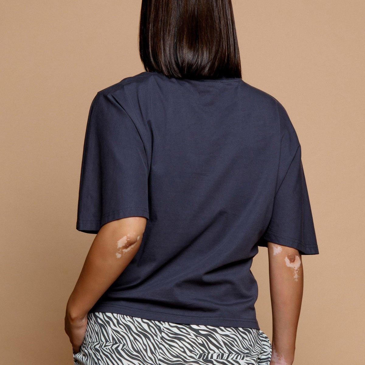 TIGER TOP